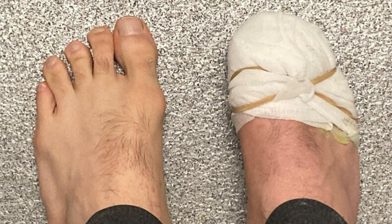 Gianpietro Pucciariello, Gout, Arthritis, Project Gianpietro Pucciariello, Gout, Arthritis, Project